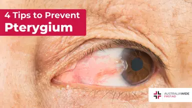 Prevent pterygium article header – First Aid Article in Castle Hill